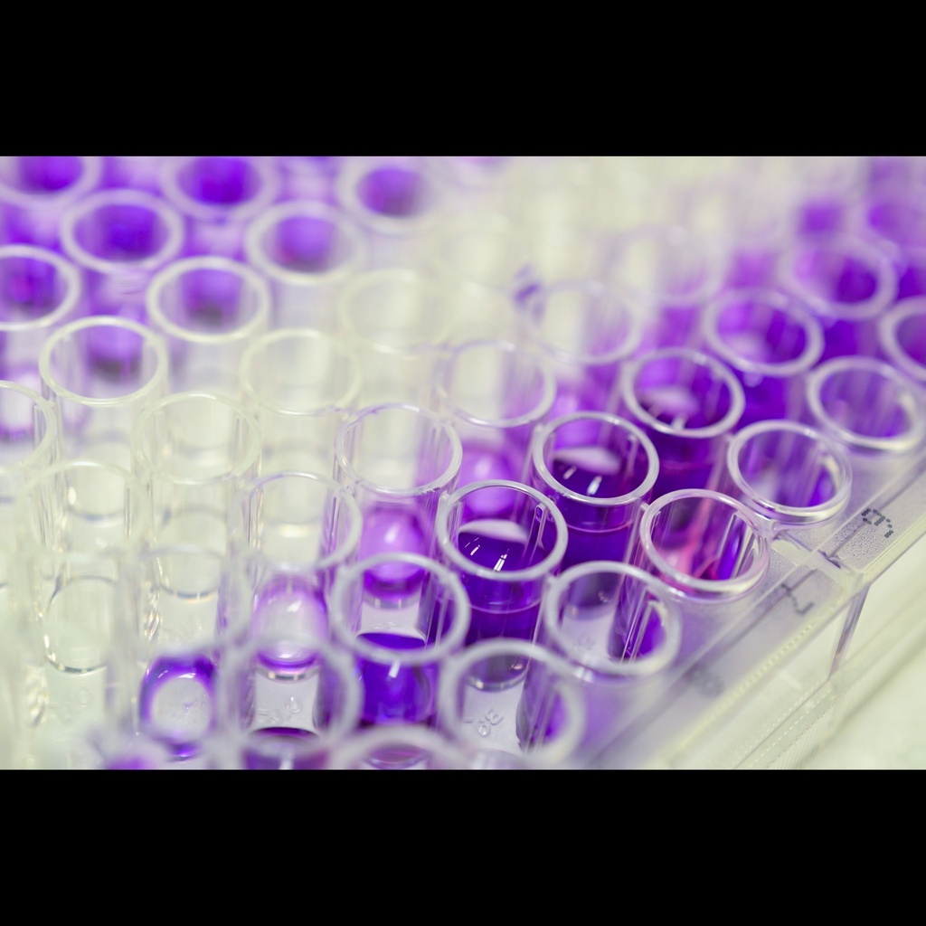 Recombinnat purified Human Plasminogen Activator Inhibitor 1 ''PAI 1'' protein ''his tag'' control for ELISA   25 ug