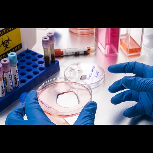 [0399-CSB-MP019024MO-20UG] E. Coli Recombinant Mouse Tyrosine protein phosphatase non receptor type 1 ''Ptpn1'', Expression: mammalian cells   20 ug